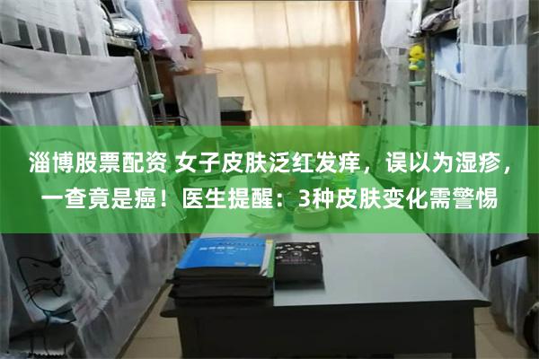 淄博股票配资 女子皮肤泛红发痒，误以为湿疹，一查竟是癌！医生提醒：3种皮肤变化需警惕